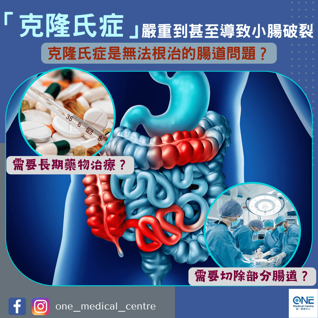 【容易被輕忽的克隆氏症】