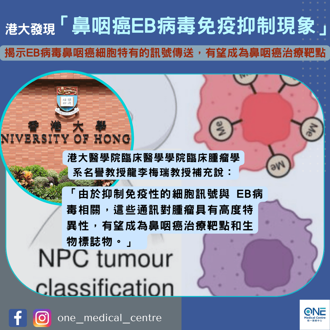 【港大醫學院發現鼻咽癌的新亞型及EB病毒免疫抑制現象，有望成為鼻咽癌治療靶點】