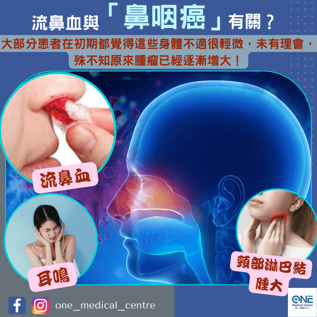 【流鼻血與鼻咽癌有關😱】