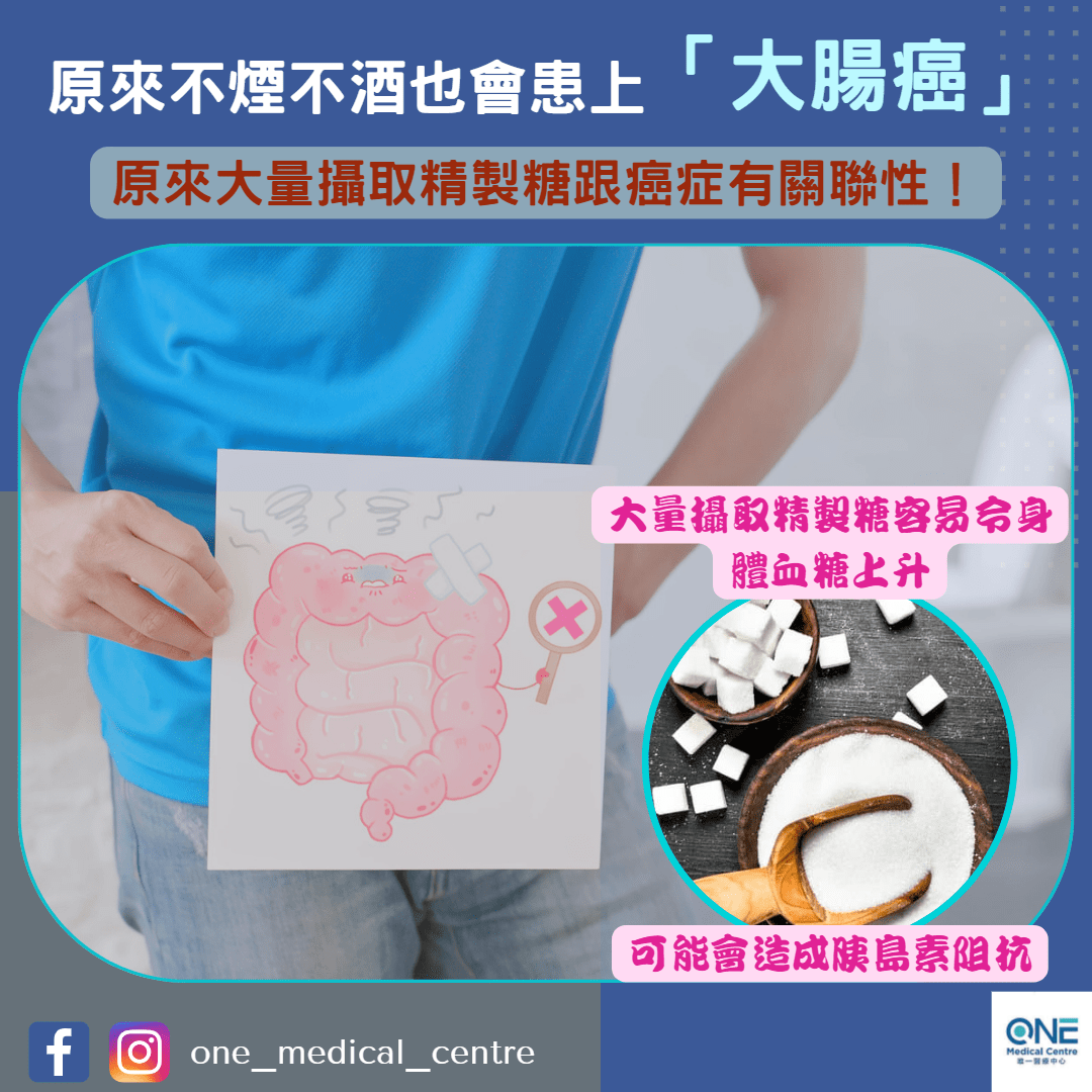 【原來不煙不酒也會患上大腸癌？】