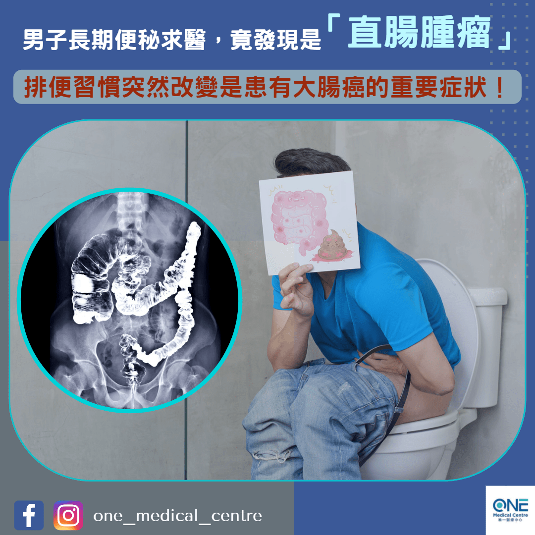 【長期便秘要留神！】