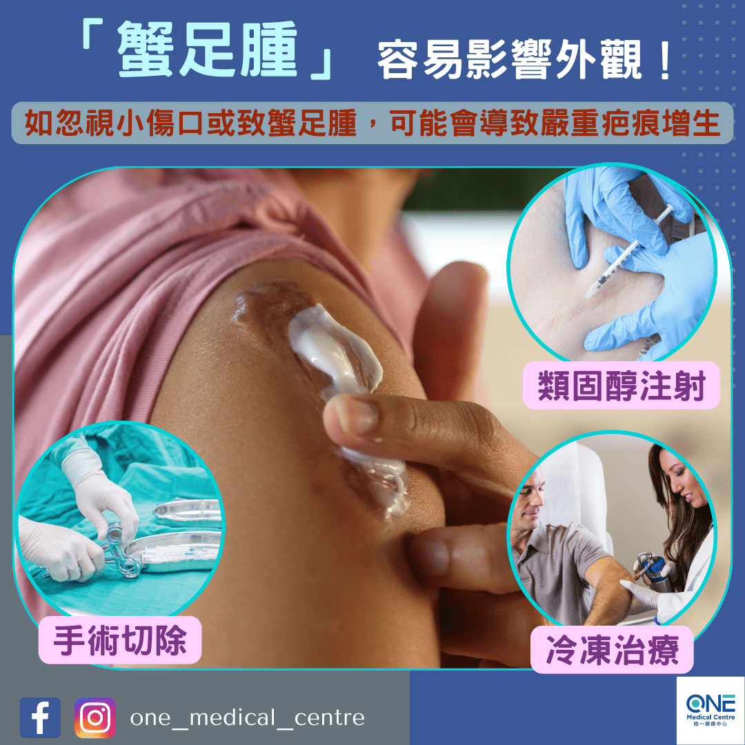【小傷口不可忽視，可致嚴重疤痕增生或蟹足腫！】