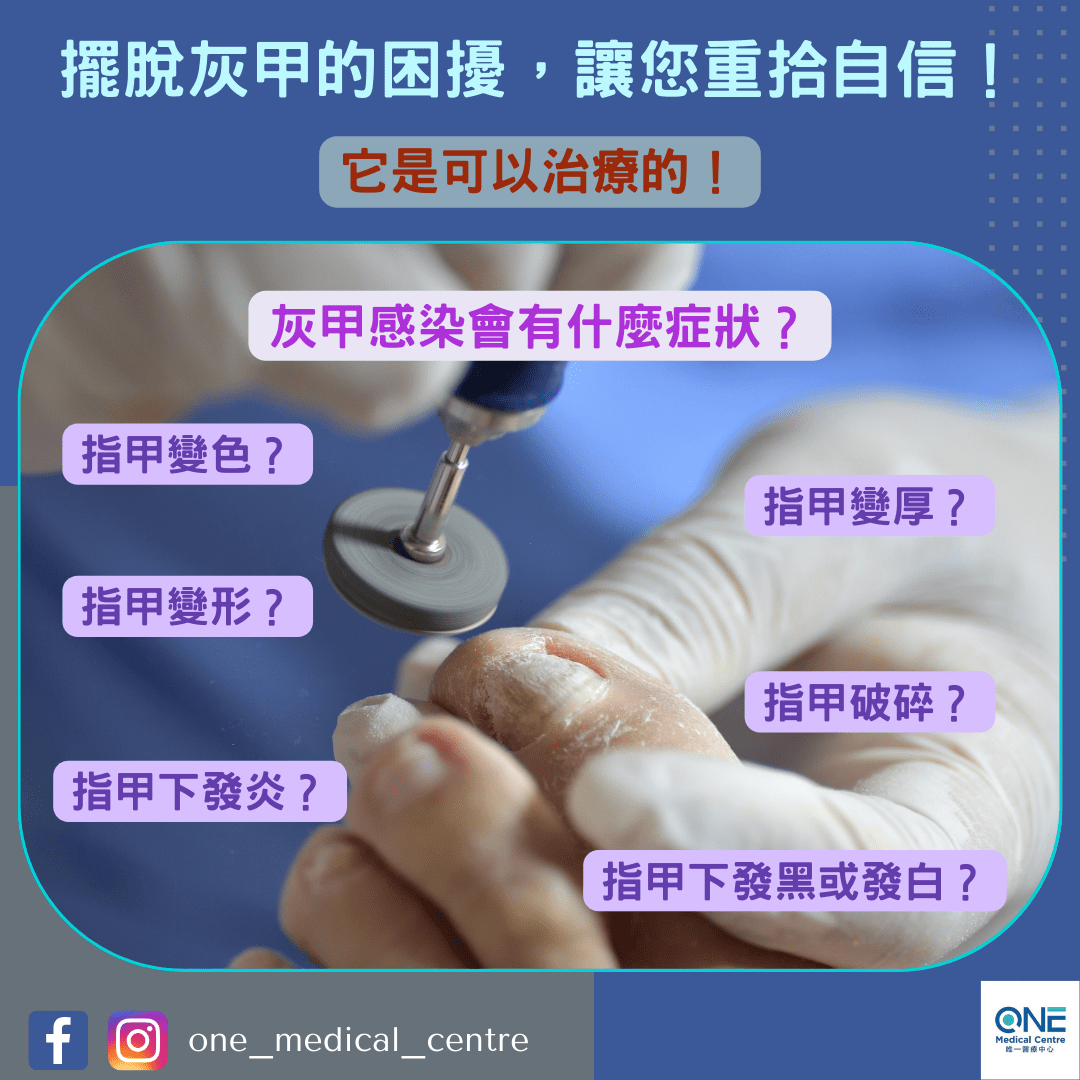 【擺脫灰甲的困擾，讓您重拾自信！👍🏻】