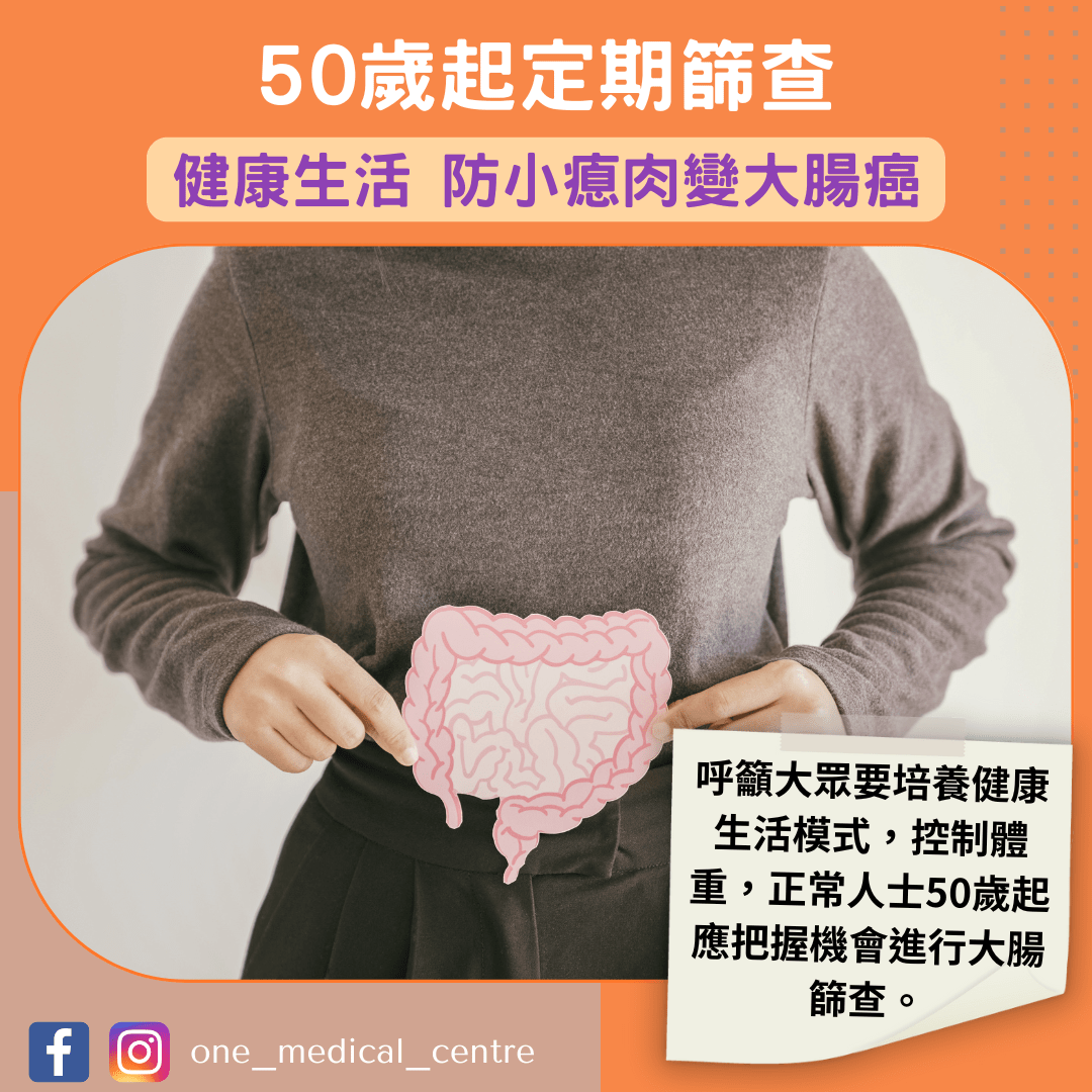 【50歲起定期篩查 健康生活 防小瘜肉變大腸癌】