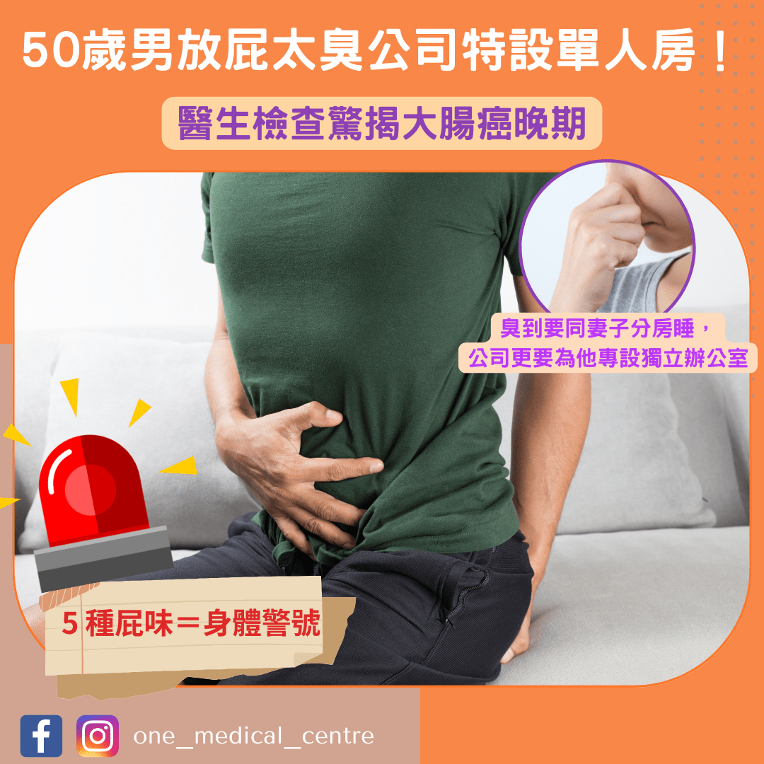 【50歲男放屁太臭公司特設單人房！醫生檢查驚揭大腸癌晚期／5大屁味成因要小心】
